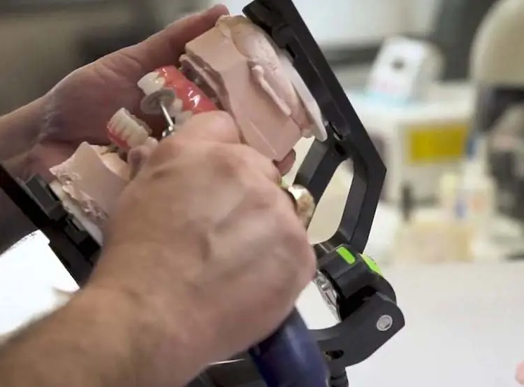 Hands working on dental mold